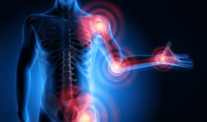 Musculoskeletal Disorders