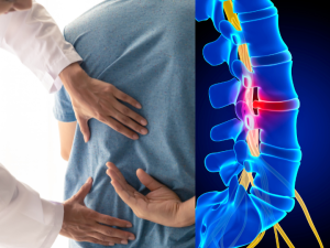 Back pain Treatment Newmarket